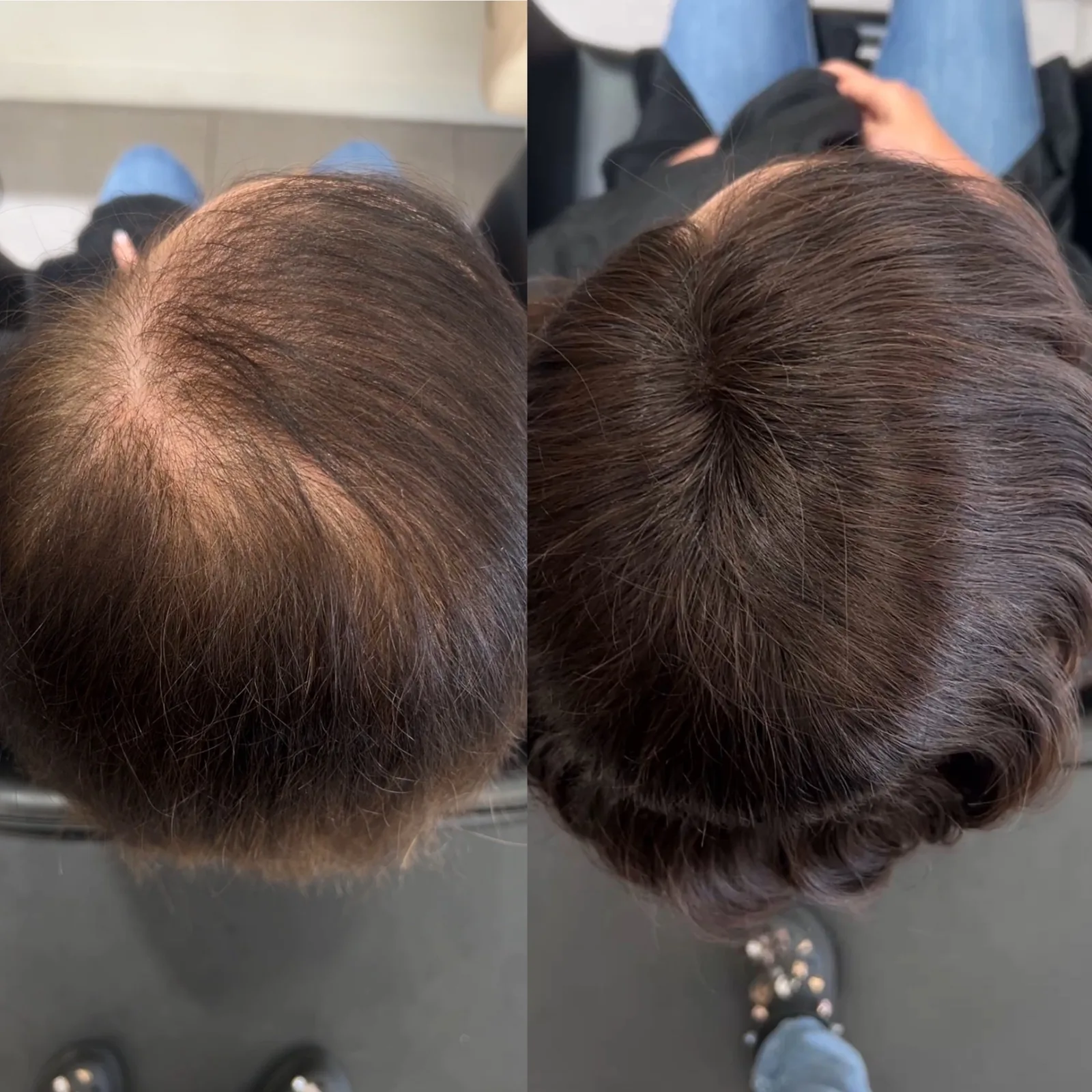 Crown density restoration with hair extensions by Baton Rouge specialists — @infinitehairstudiobr